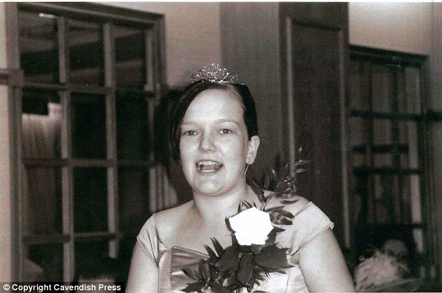 Η φρίκη των ναρκωτικών -Η παραμόρφωση νεαρής από χρήση ουσίας, που σόκαρε [εικόνες] | iefimerida.gr 4