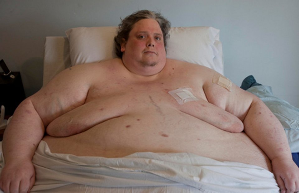 Πέθανε στα 44 του ο παχύτερος άνθρωπος στον κόσμο [εικόνες & βίντεο]  | iefimerida.gr 0