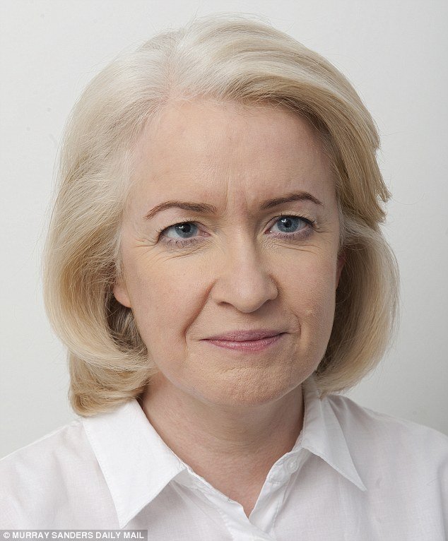 Το νέο τύπου λίφτινγκ που κάνει θραύση: Σφίγγουν το δέρμα με νήματα -Χωρίς τομές, χωρίς μεγάλο κόστος [εικόνες] | iefimerida.gr 0