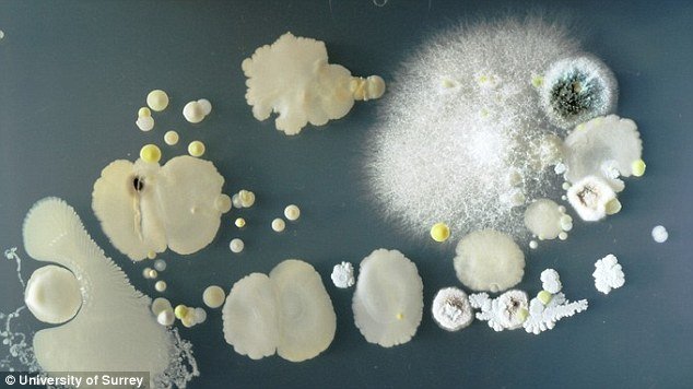 Τα κινητά είναι πιο βρώμικα και από την τουαλέτα -Τα τηλέφωνα στο μικροσκόπιο προκαλούν... αηδία [εικόνες] | iefimerida.gr 2