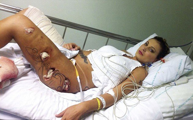 H Mις Bumbum έπαθε σηπτικό σοκ από εμφυτεύματα στα οπίσθια [εικόνες] | iefimerida.gr 0