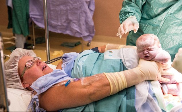 Απίστευτη στιγμή: Γυναίκα έβγαλε μόνη της τα παιδιά της από την κοιλιά της μετά από καισαρική τομή [εικόνες] | iefimerida.gr 0