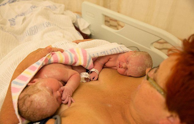 Απίστευτη στιγμή: Γυναίκα έβγαλε μόνη της τα παιδιά της από την κοιλιά της μετά από καισαρική τομή [εικόνες] | iefimerida.gr 2