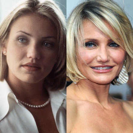 20 πασίγνωστες ηθοποιοί, τραγουδίστριες, παρουσιάστριες πριν και μετά τις πλαστικές [εικόνες] | iefimerida.gr 9