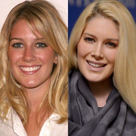 20 πασίγνωστες ηθοποιοί, τραγουδίστριες, παρουσιάστριες πριν και μετά τις πλαστικές [εικόνες] | iefimerida.gr 10