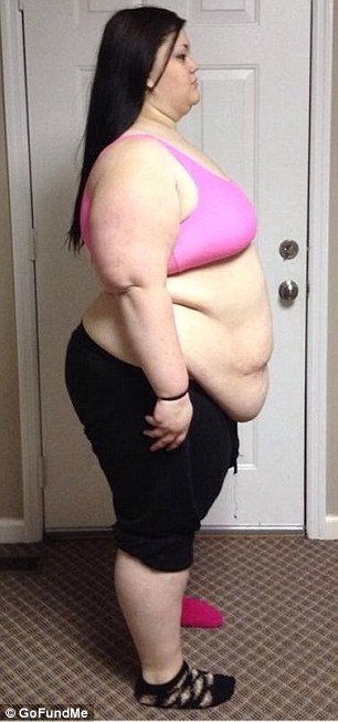 Ετσι γίνεται το σώμα μετά από μεγάλη απώλεια κιλών -Η 19χρονη που ζύγιζε 188 κιλά και έχασε 95 [εικόνες] | iefimerida.gr 0