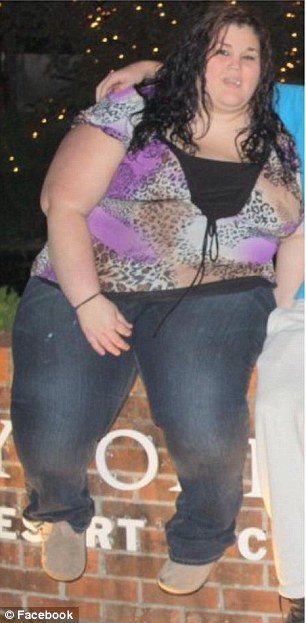 Ετσι γίνεται το σώμα μετά από μεγάλη απώλεια κιλών -Η 19χρονη που ζύγιζε 188 κιλά και έχασε 95 [εικόνες] | iefimerida.gr 2