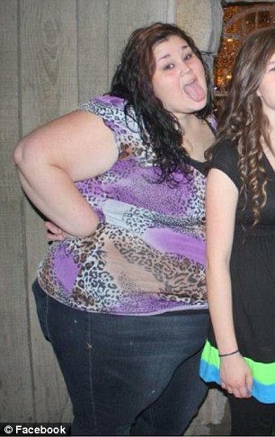 Ετσι γίνεται το σώμα μετά από μεγάλη απώλεια κιλών -Η 19χρονη που ζύγιζε 188 κιλά και έχασε 95 [εικόνες] | iefimerida.gr 4