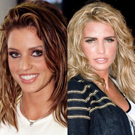 20 πασίγνωστες ηθοποιοί, τραγουδίστριες, παρουσιάστριες πριν και μετά τις πλαστικές [εικόνες] | iefimerida.gr 13