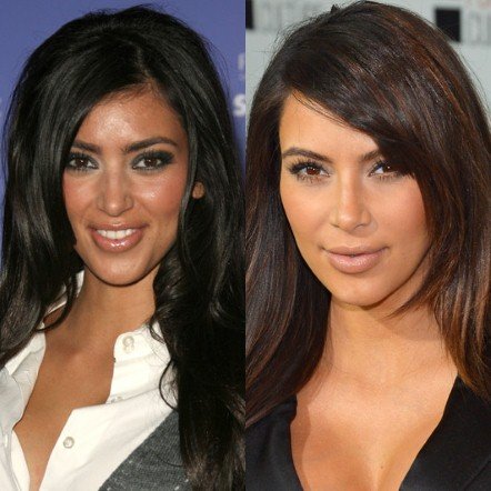 20 πασίγνωστες ηθοποιοί, τραγουδίστριες, παρουσιάστριες πριν και μετά τις πλαστικές [εικόνες] | iefimerida.gr 4