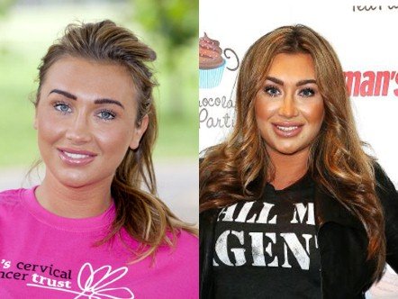 20 πασίγνωστες ηθοποιοί, τραγουδίστριες, παρουσιάστριες πριν και μετά τις πλαστικές [εικόνες] | iefimerida.gr 17