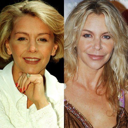 20 πασίγνωστες ηθοποιοί, τραγουδίστριες, παρουσιάστριες πριν και μετά τις πλαστικές [εικόνες] | iefimerida.gr 15