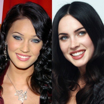 20 πασίγνωστες ηθοποιοί, τραγουδίστριες, παρουσιάστριες πριν και μετά τις πλαστικές [εικόνες] | iefimerida.gr 5