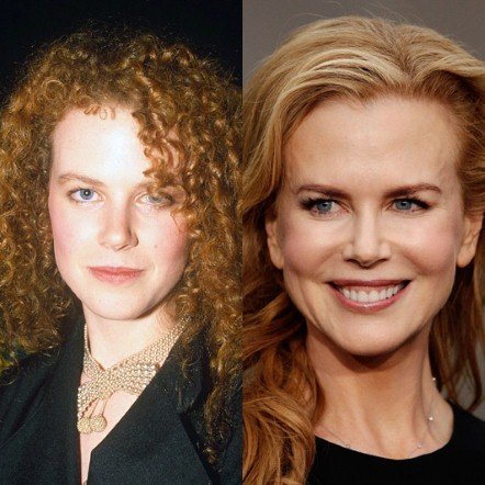 20 πασίγνωστες ηθοποιοί, τραγουδίστριες, παρουσιάστριες πριν και μετά τις πλαστικές [εικόνες] | iefimerida.gr 7