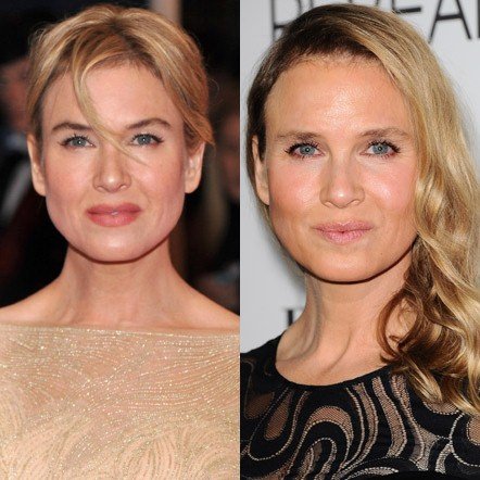 20 πασίγνωστες ηθοποιοί, τραγουδίστριες, παρουσιάστριες πριν και μετά τις πλαστικές [εικόνες] | iefimerida.gr 1