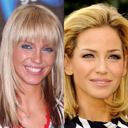 20 πασίγνωστες ηθοποιοί, τραγουδίστριες, παρουσιάστριες πριν και μετά τις πλαστικές [εικόνες] | iefimerida.gr 14