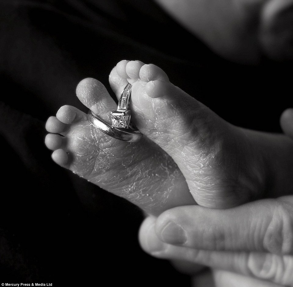 Το πιο σπαρακτικό αντίο: Γονείς αποχαιρετούν τα ετοιμοθάνατα, λίγων ημερών, μωρά τους [εικόνες] | iefimerida.gr 7