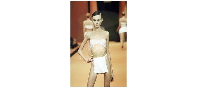 Προκάλεσε κατακραυγή: Φωτογραφίες άρρωστα αποστεωμένου μοντέλου σε περιοδικό μόδας [εικόνες] | iefimerida.gr 4