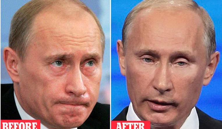 Ο Πούτιν έκανε λίφτινγκ -Οι φωτογραφίες πριν και μετά [εικόνες] | iefimerida.gr 0