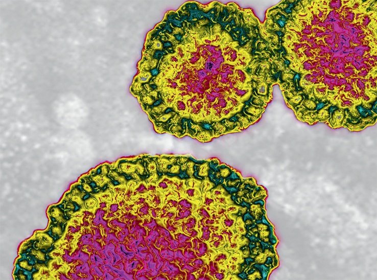 Ανθρώπινο σώμα ή... σουρεαλιστικό έργο τέχνης; - 10 φωτογραφίες αποκαλύπτουν [εικόνες] | iefimerida.gr 5