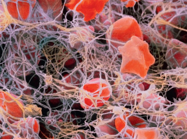 Ανθρώπινο σώμα ή... σουρεαλιστικό έργο τέχνης; - 10 φωτογραφίες αποκαλύπτουν [εικόνες] | iefimerida.gr 7