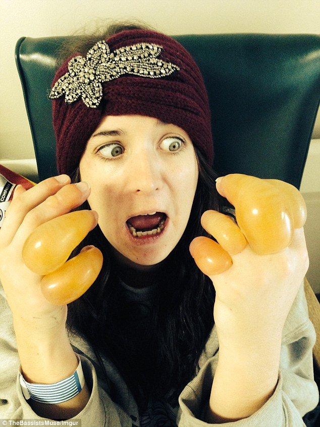 Επαθε χιονίστρες στα δάχτυλα όταν έπεσε ξερή από μεθύσι έξω από μπαρ [εικόνες] | iefimerida.gr 6