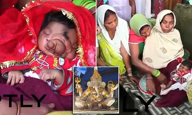 Μωρό γεννήθηκε με προβοσκίδα και λατρεύεται σαν θεός [βίντεο] | iefimerida.gr 1