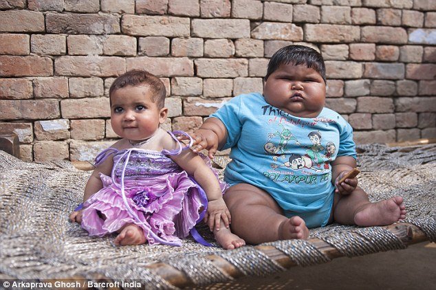 Σοκαριστικό: Κοριτσάκι στην Ινδία είναι μόλις 10 μηνών, αλλά ζυγίζει 20 κιλά [εικόνες] | iefimerida.gr 6