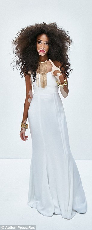 Η 19χρονη καλλονή με τη λεύκη που νίκησε τον ρατσισμό και μεσουρανεί σε διεθνείς πασαρέλες [εικόνες] | iefimerida.gr 4