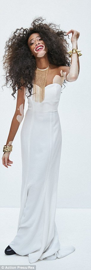 Η 19χρονη καλλονή με τη λεύκη που νίκησε τον ρατσισμό και μεσουρανεί σε διεθνείς πασαρέλες [εικόνες] | iefimerida.gr 3