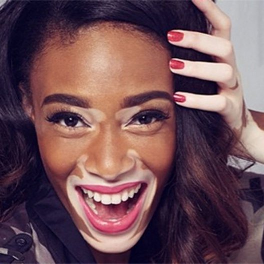 Η 19χρονη καλλονή με τη λεύκη που νίκησε τον ρατσισμό και μεσουρανεί σε διεθνείς πασαρέλες [εικόνες] | iefimerida.gr 9