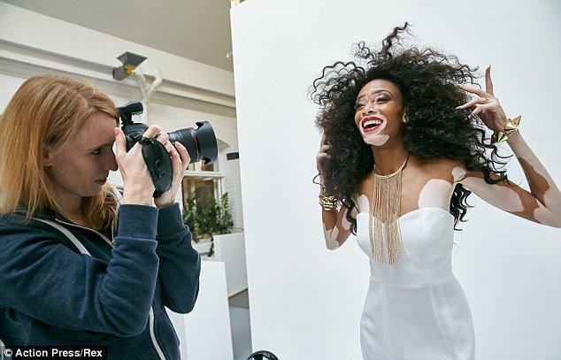 Η 19χρονη καλλονή με τη λεύκη που νίκησε τον ρατσισμό και μεσουρανεί σε διεθνείς πασαρέλες [εικόνες] | iefimerida.gr 5