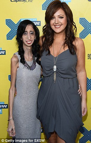 Ραγίζει καρδιές «η πιο άσχημη γυναίκα στον κόσμο»: Η εκστρατεία της κατά του bullying [εικόνες & βίντεο] | iefimerida.gr 0