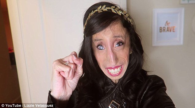 Ραγίζει καρδιές «η πιο άσχημη γυναίκα στον κόσμο»: Η εκστρατεία της κατά του bullying [εικόνες & βίντεο] | iefimerida.gr 2