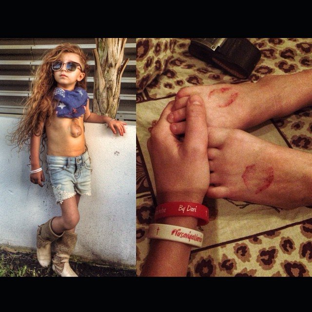 Συγκλονίζει η 5χρονη που ζει με την καρδιά έξω από το σώμα της [εικόνες] | iefimerida.gr 0