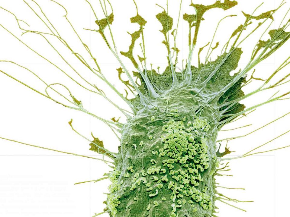 Ανθρώπινο σώμα ή... σουρεαλιστικό έργο τέχνης; - 10 φωτογραφίες αποκαλύπτουν [εικόνες] | iefimerida.gr 8