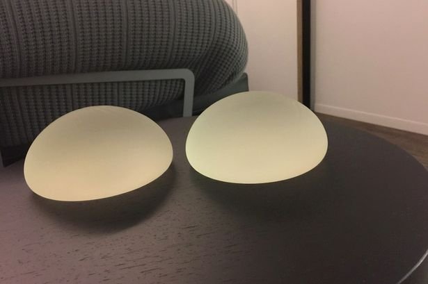 Εβγαλε πολλά κιλά στήθος και νιώθει καλύτερα [εικόνες] | iefimerida.gr 4