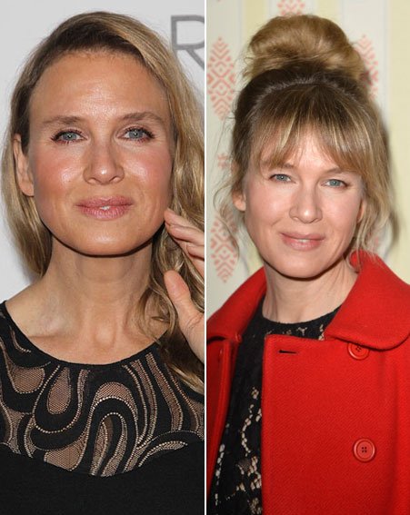 Η Ζελβέγκερ βρήκε το παλιό της πρόσωπο [εικόνες] | iefimerida.gr 7