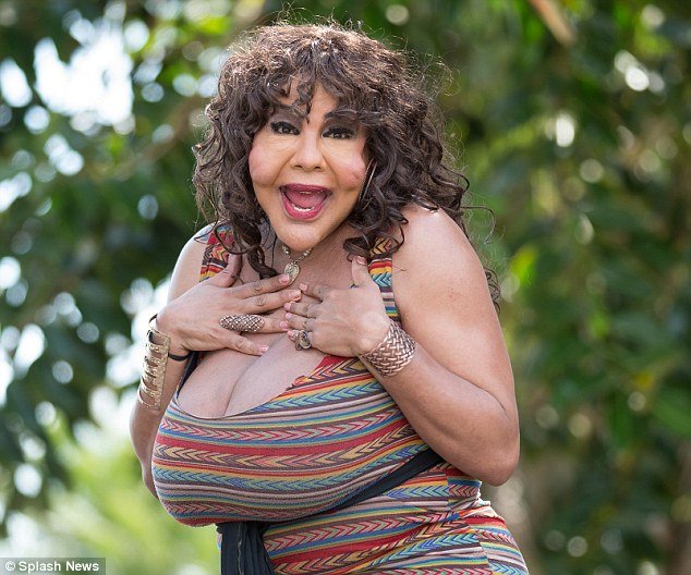 Φρίκη: Εβαλαν σε τρανσέξουαλ, με ενέσεις, τσιμέντο στο πρόσωπο [εικόνες] | iefimerida.gr 5