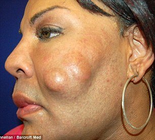 Φρίκη: Εβαλαν σε τρανσέξουαλ, με ενέσεις, τσιμέντο στο πρόσωπο [εικόνες] | iefimerida.gr 3