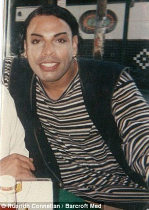 Φρίκη: Εβαλαν σε τρανσέξουαλ, με ενέσεις, τσιμέντο στο πρόσωπο [εικόνες] | iefimerida.gr 0