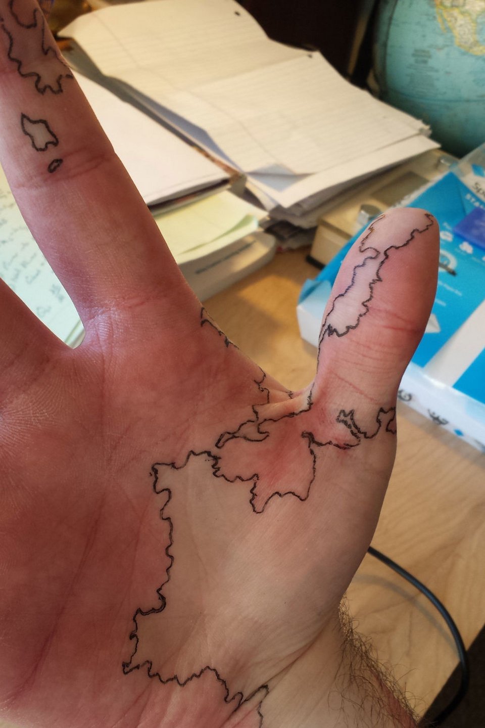 Μεταμόρφωσε τα εκ γενετής σημάδια του σε... χάρτη κόσμου [εικόνες] | iefimerida.gr 0