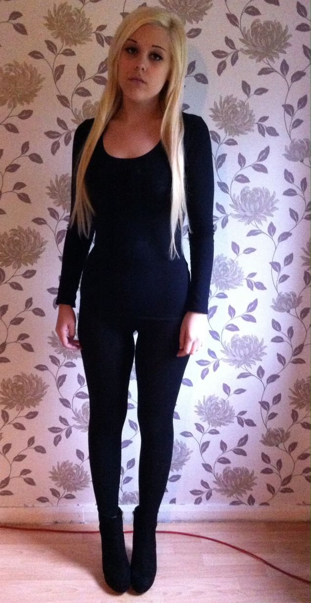 Η σπαρακτική κραυγή 20χρονης που έχασε 114 κιλά εξαιτίας της νόσου του Κρον [εικόνες] | iefimerida.gr 4