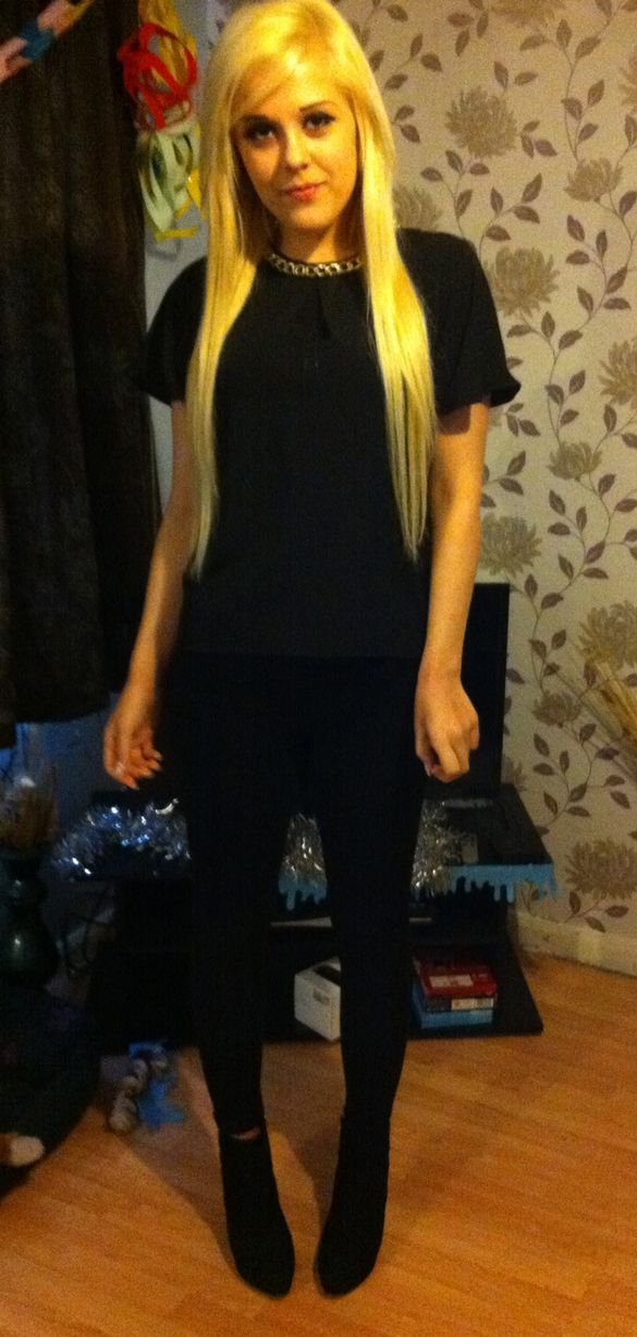 Η σπαρακτική κραυγή 20χρονης που έχασε 114 κιλά εξαιτίας της νόσου του Κρον [εικόνες] | iefimerida.gr 5