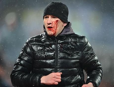 Απίστευτης αγριότητας επεισόδια σε ποδοσφαιρικό αγώνα στη Ρωσία [εικόνες & βίντεο] | iefimerida.gr 0