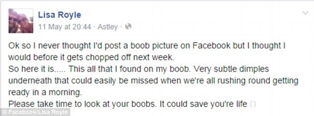 Το λακκάκι στο στήθος που έγινε viral -Γυναίκα με καρκίνο του μαστού δείχνει τα προειδοποιητικά σημάδια [εικόνες]           | iefimerida.gr 0