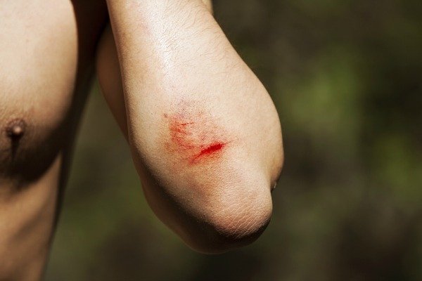 Δέκα περίεργα πράγματα που κάνει το ανθρώπινο σώμα [εικόνες] | iefimerida.gr 8