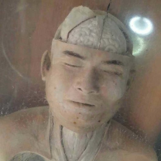 Σκελετοί, εγκέφαλοι και μωρά σε φορμόλη - Το μουσείο του θανάτου βρίσκεται στη Μπανγκόκ [εικόνες]  | iefimerida.gr 7