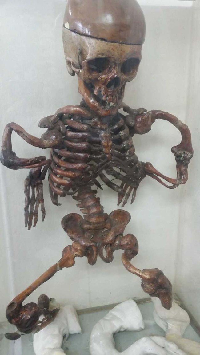 Σκελετοί, εγκέφαλοι και μωρά σε φορμόλη - Το μουσείο του θανάτου βρίσκεται στη Μπανγκόκ [εικόνες]  | iefimerida.gr 6