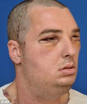 Γυναίκα βλέπει για πρώτη φορά το πρόσωπο του νεκρού της αδερφού σε σώμα ενός άλλου άνδρα [εικόνες]   | iefimerida.gr 4